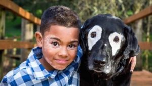 Garoto com vitiligo recupera a autoestima
