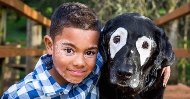 Garoto com vitiligo recupera a autoestima conhecendo um cão com a mesa condição que ele